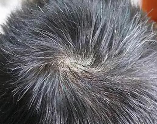 白发长在前额、两鬓、后脑勺，分别代表什么呢？看完涨知识了
